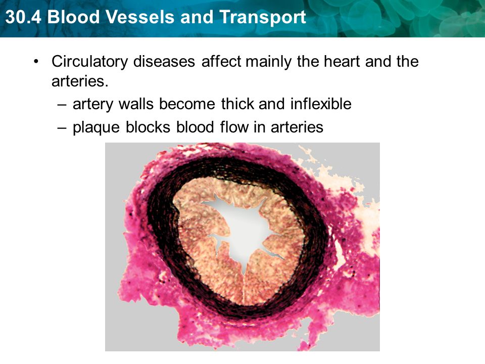 Circulatory diseases affect mainly the heart and the arteries.