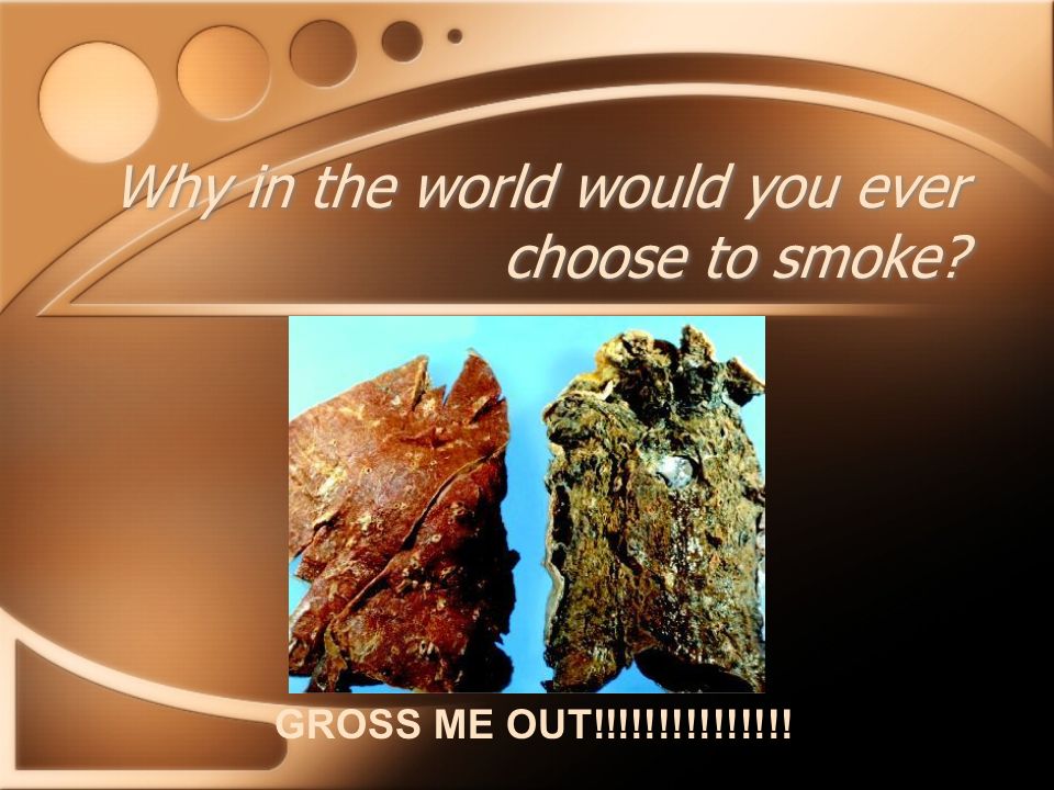 Why in the world would you ever choose to smoke