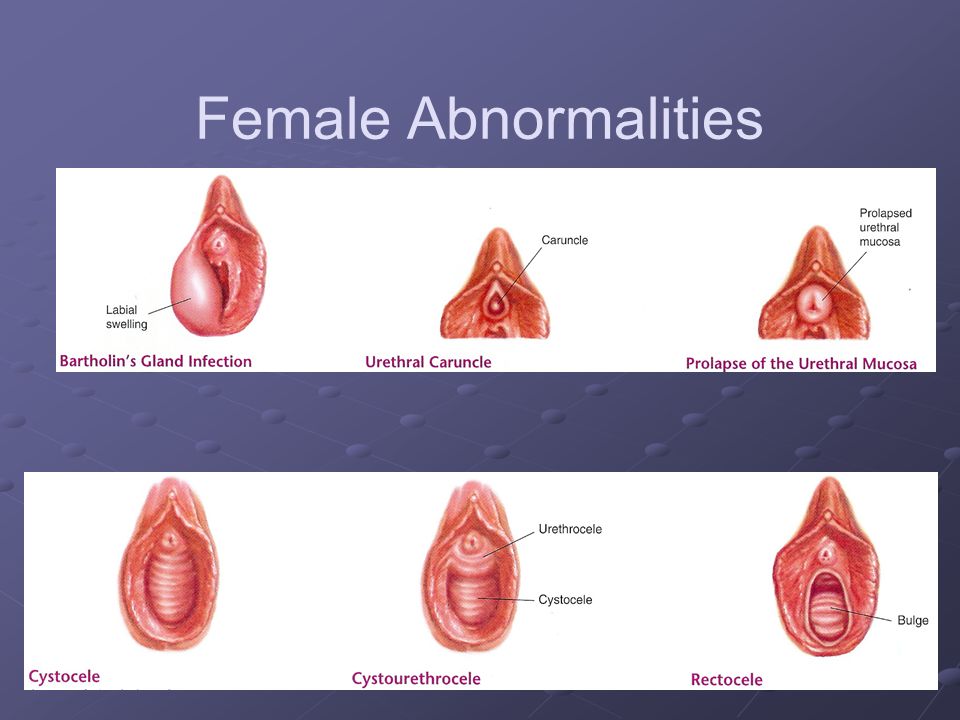 Female & Male Genitalia - ppt video online download