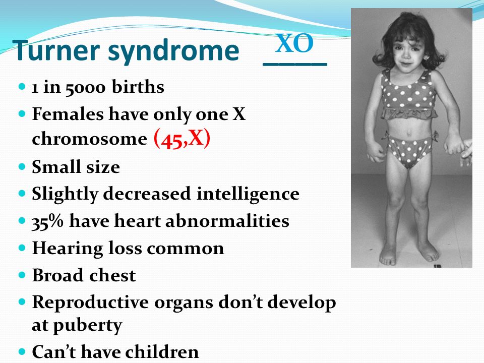 14-2 Human Chromosomes. - ppt video online download