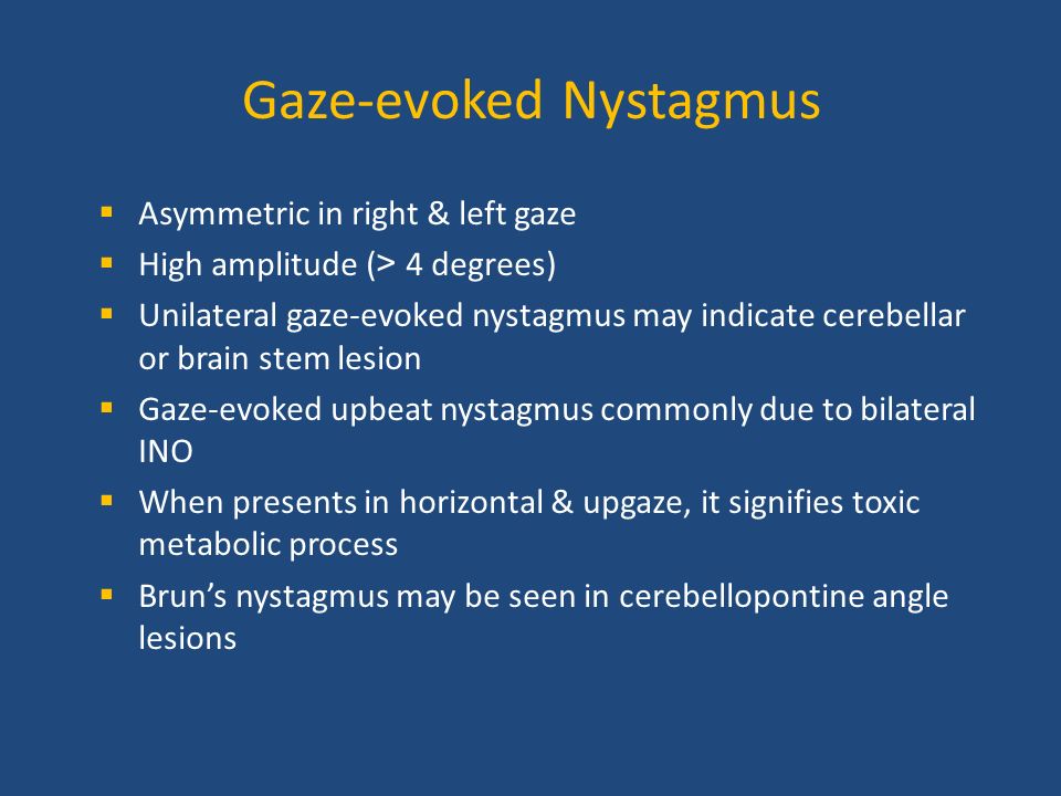 Nystagmus a clinical approach ppt video online download