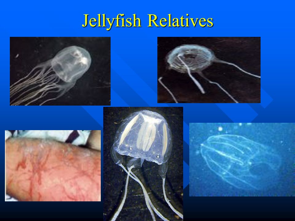 Jellyfish Relatives