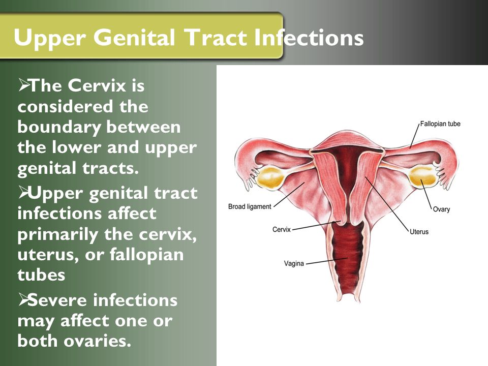 Upper genital tract infections affect primarily the cervix, uterus, or fall...