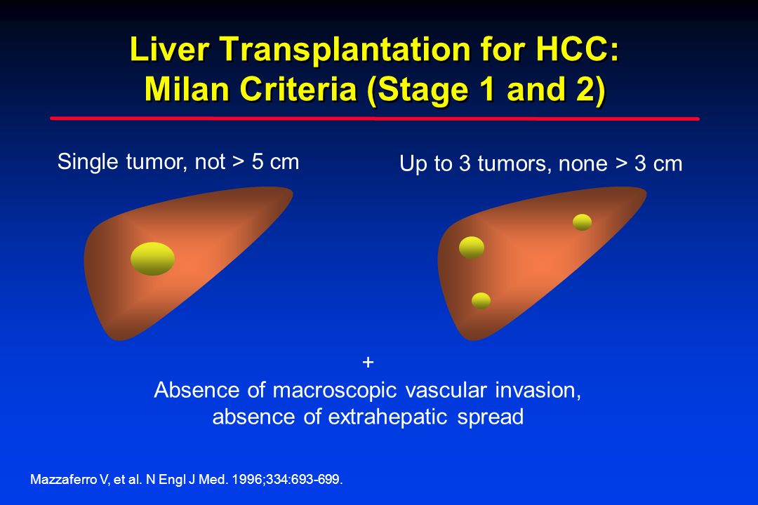 Liver Transplantation for HCC: Milan Criteria (Stage 1 and 2)