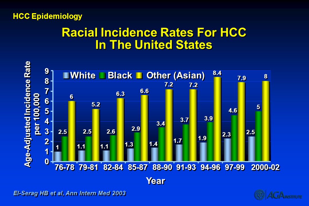 Racial Incidence Rates For HCC In The United States