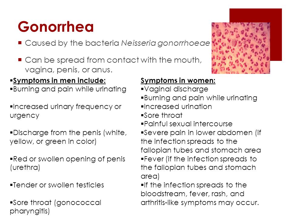 Gonorrhea Caused by the bacteria Neisseria gonorrhoeae 
