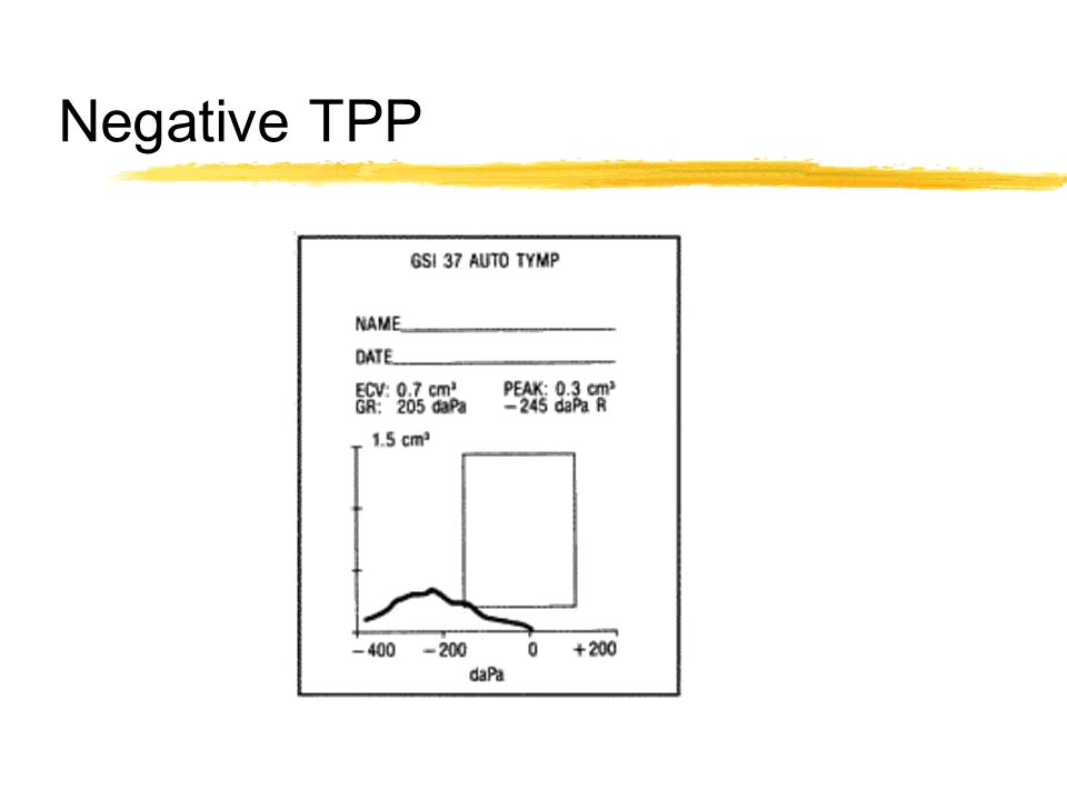 Negative TPP
