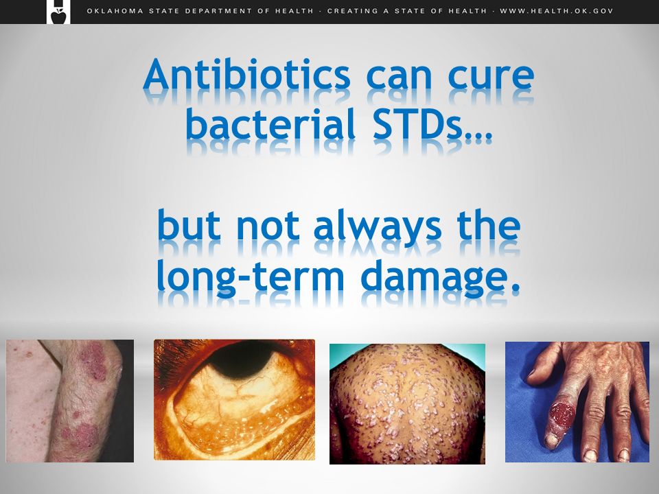 Sexually Transmitted Diseases - Ppt Download