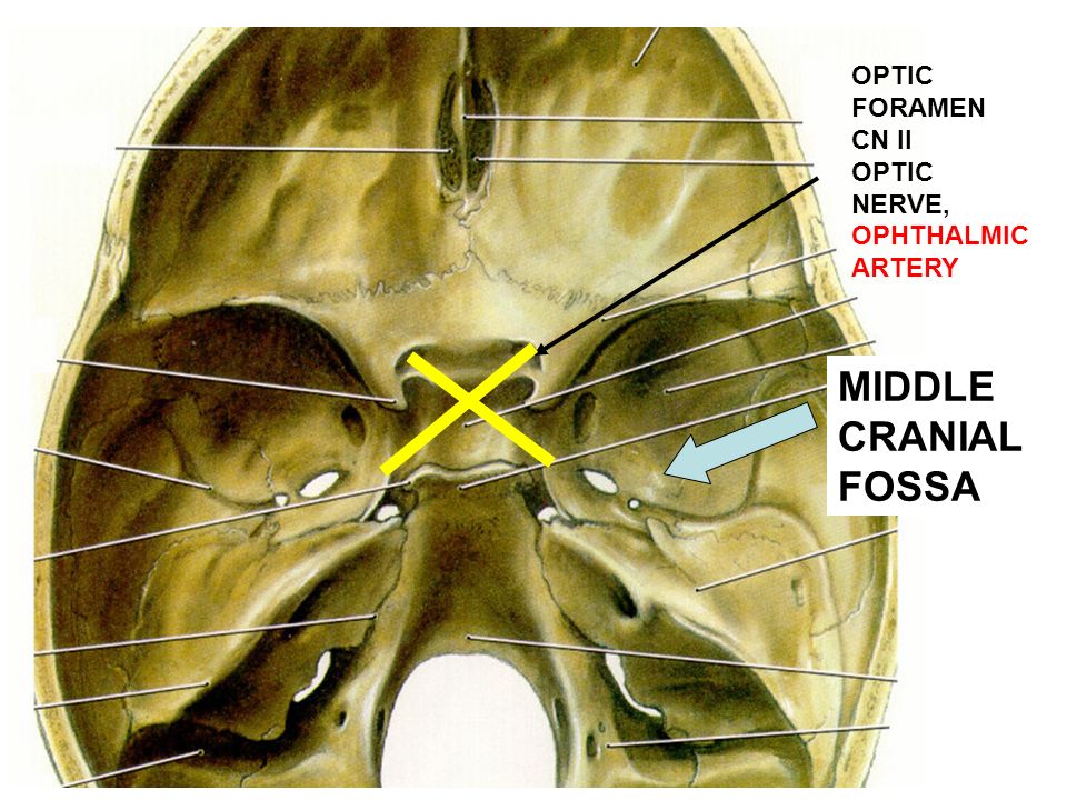 MIDDLE CRANIAL FOSSA OPTIC FORAMEN CN II OPTIC NERVE, OPHTHALMIC