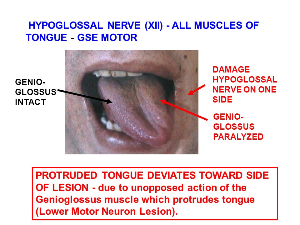 Review Of Head And Neck Cranial Nerves Etc Ppt Video Online Download