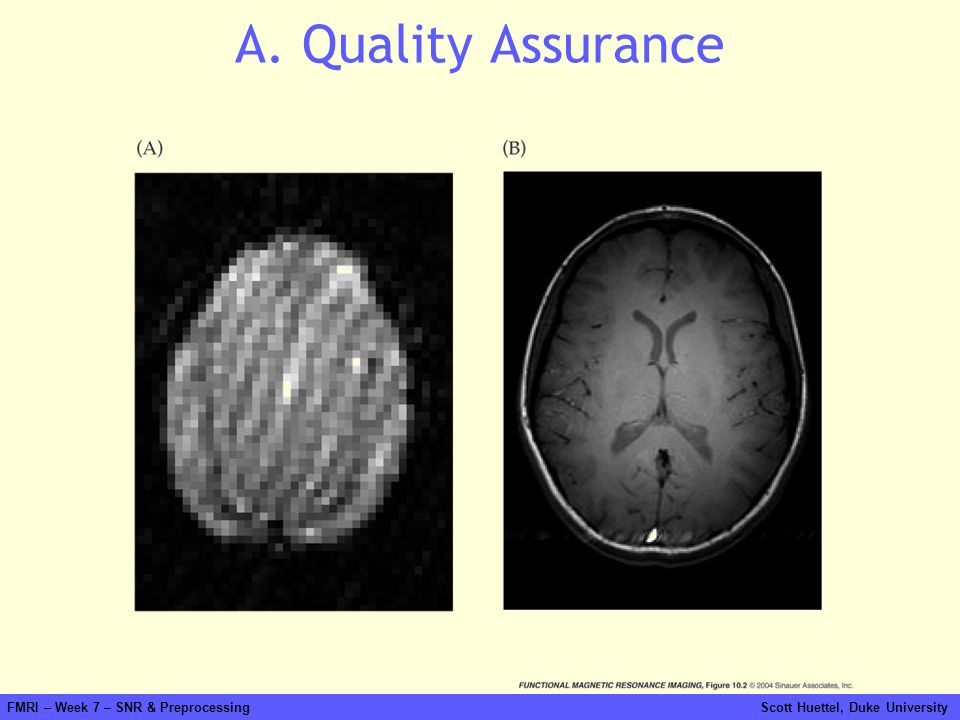 A. Quality Assurance fmri-fig jpg