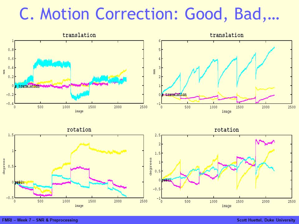 C. Motion Correction: Good, Bad,…