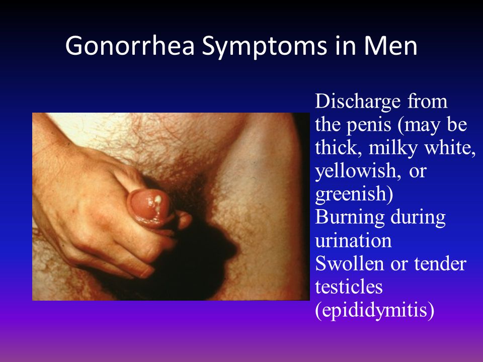 Gonorrhoea Symptoms Testing