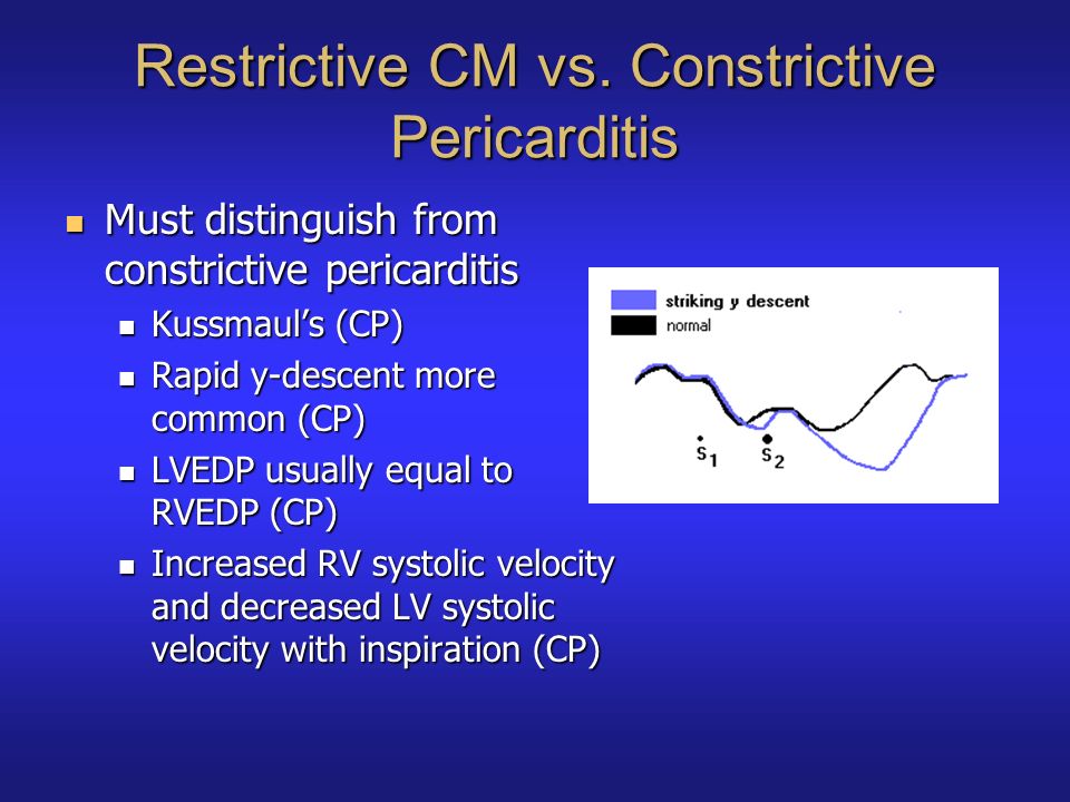 Cardiomyopathies. - ppt download