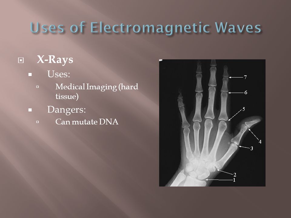 Uses of Electromagnetic Waves