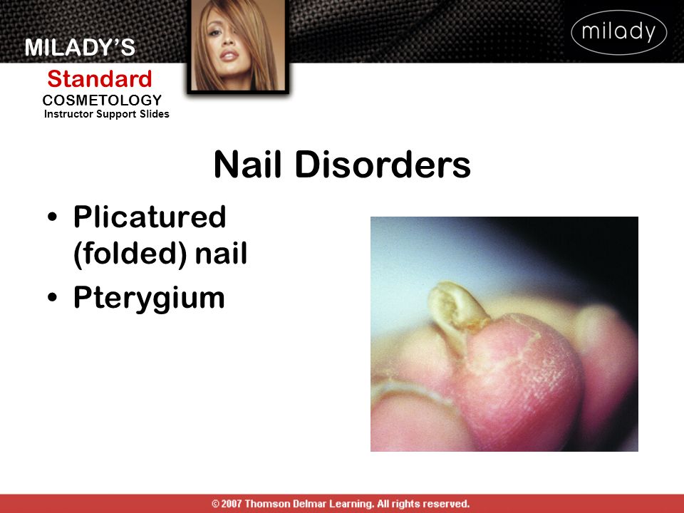 Nail Diseases Disorders Ppt Video Online Download Nail Diseases Disorders Ppt Video Online Download