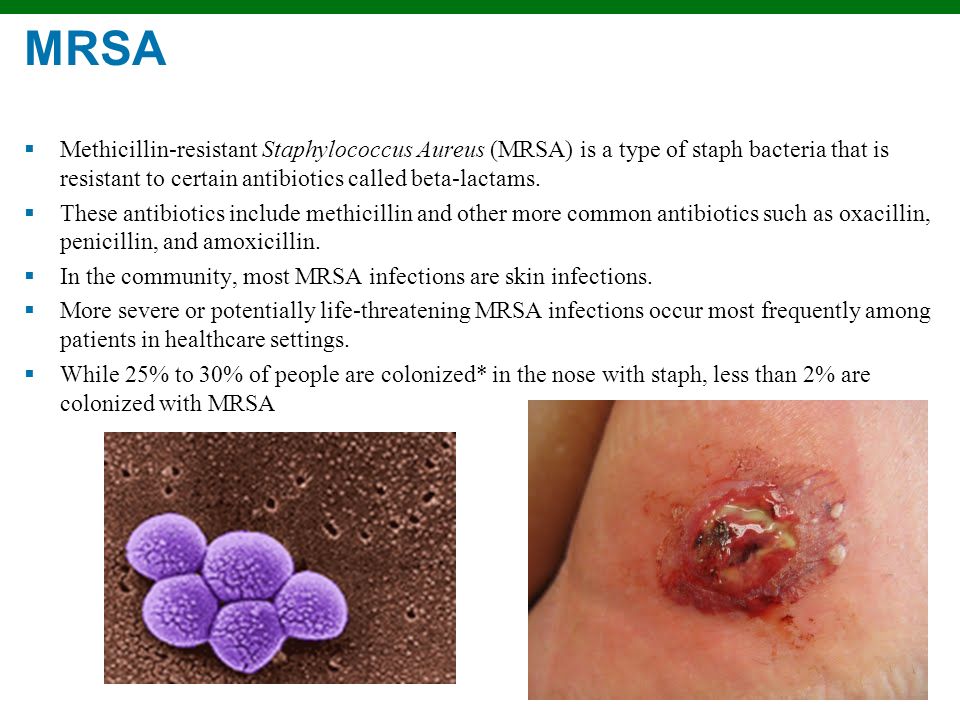 Is mrsa sexual