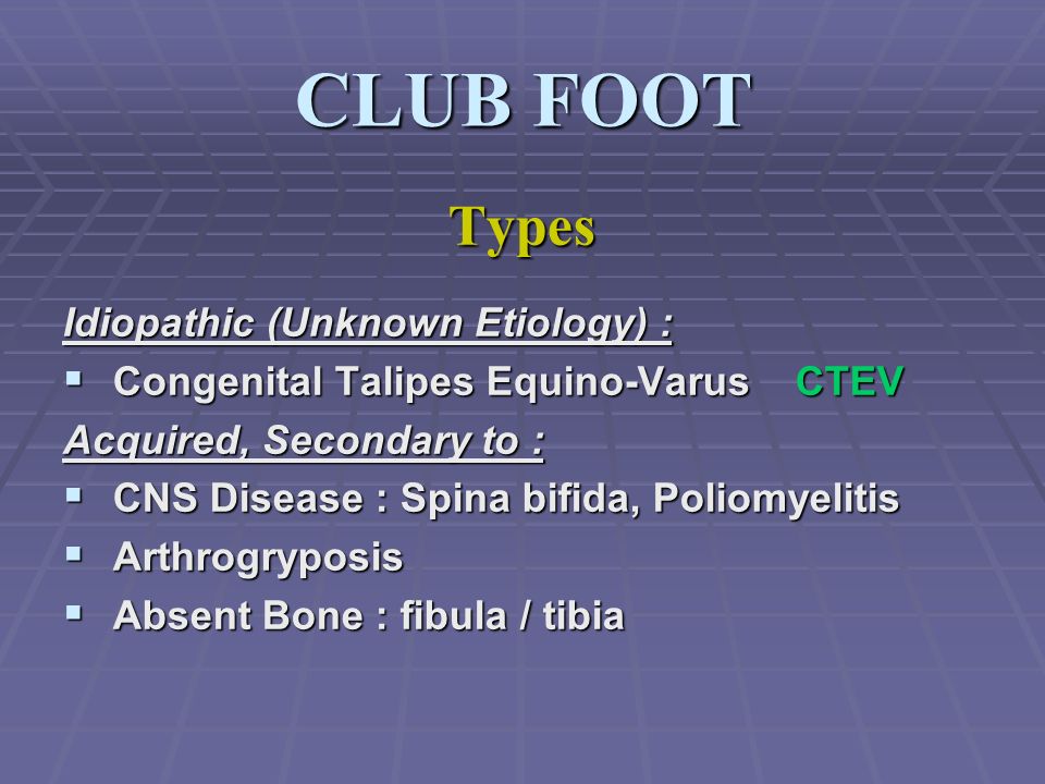 Congenital Talipes Equino Varus Congenital Clubfoot Ppt Video Online Download