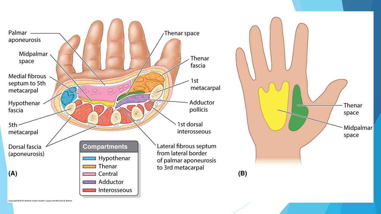 Hand Musculature and Vasculature, Cross sections, Review - ppt video online  download