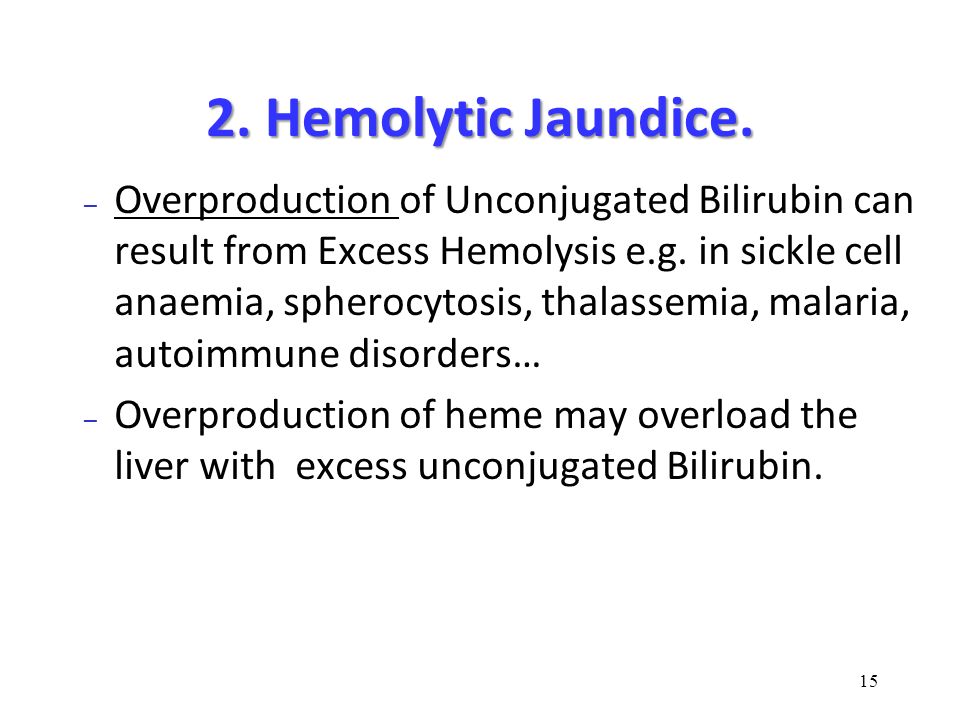 2. Hemolytic Jaundice.