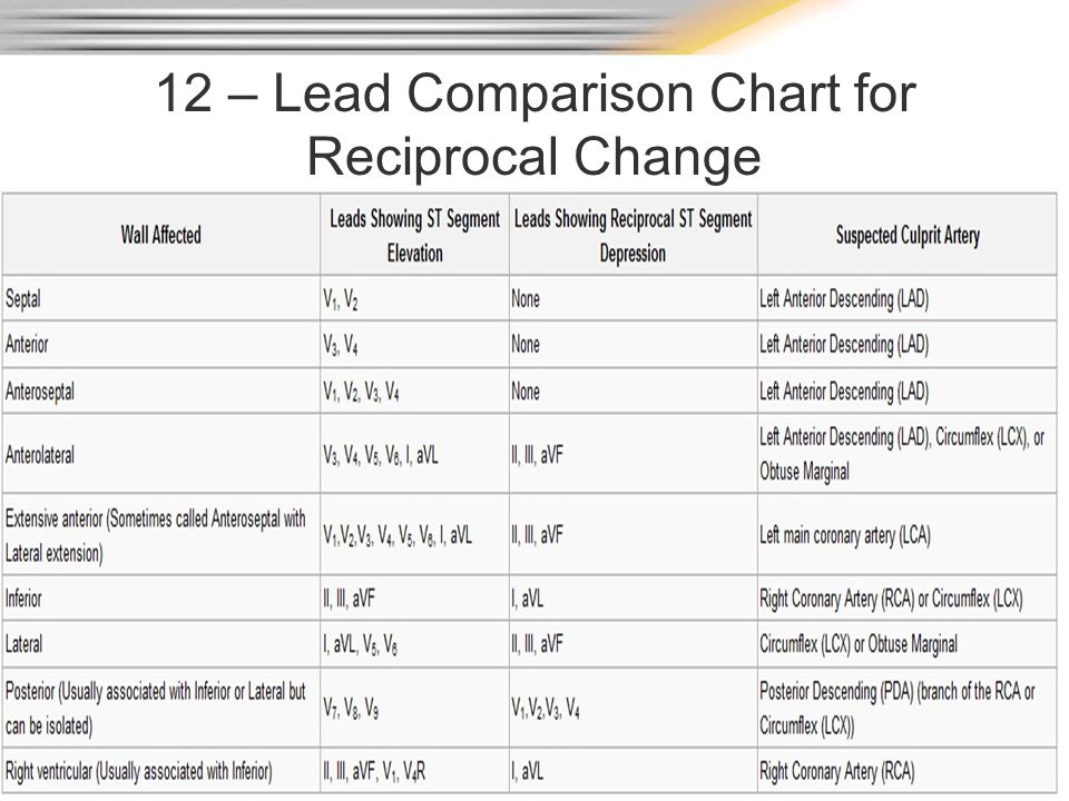 12 – Lead Comparison Chart for Reciprocal Change