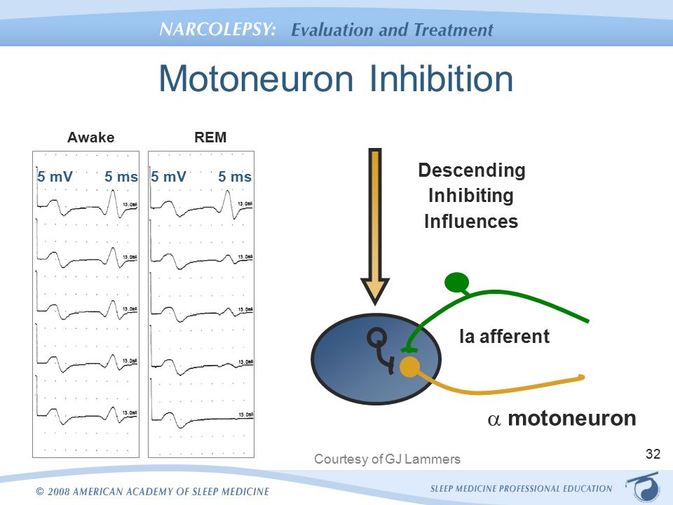 Motoneuron Inhibition