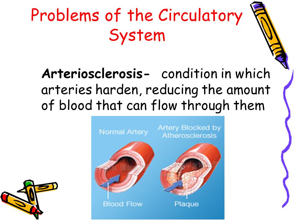 Problems of the Circulatory System