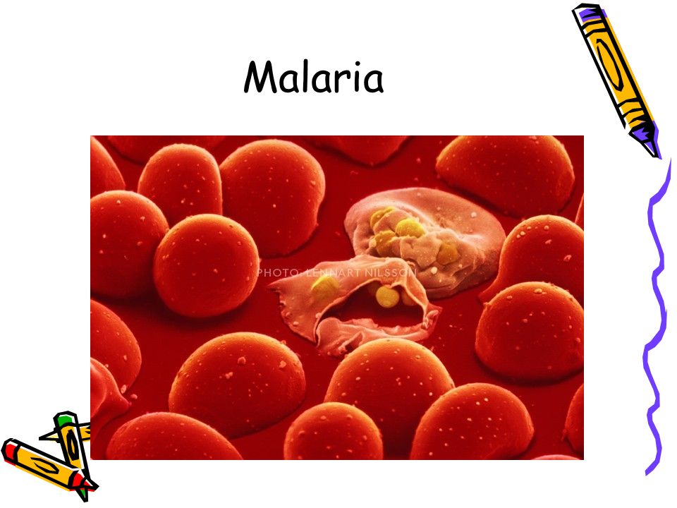 Malaria Malaria in RBC’s