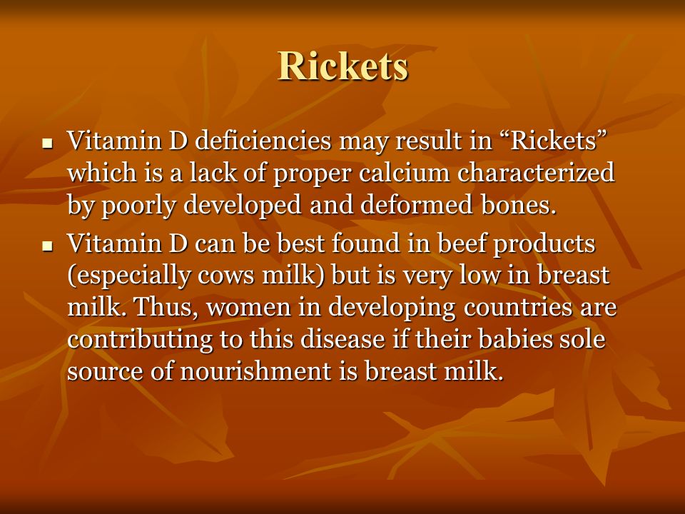 Rickets Vitamin D deficiencies may result in Rickets which is a lack of proper calcium characterized by poorly developed and deformed bones.