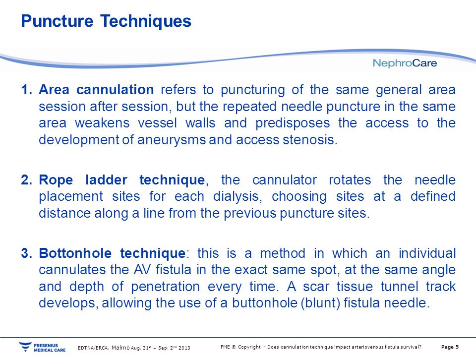 Does Cannulation Technique Impact Arteriovenous Fistula Survival Ppt Video Online Download