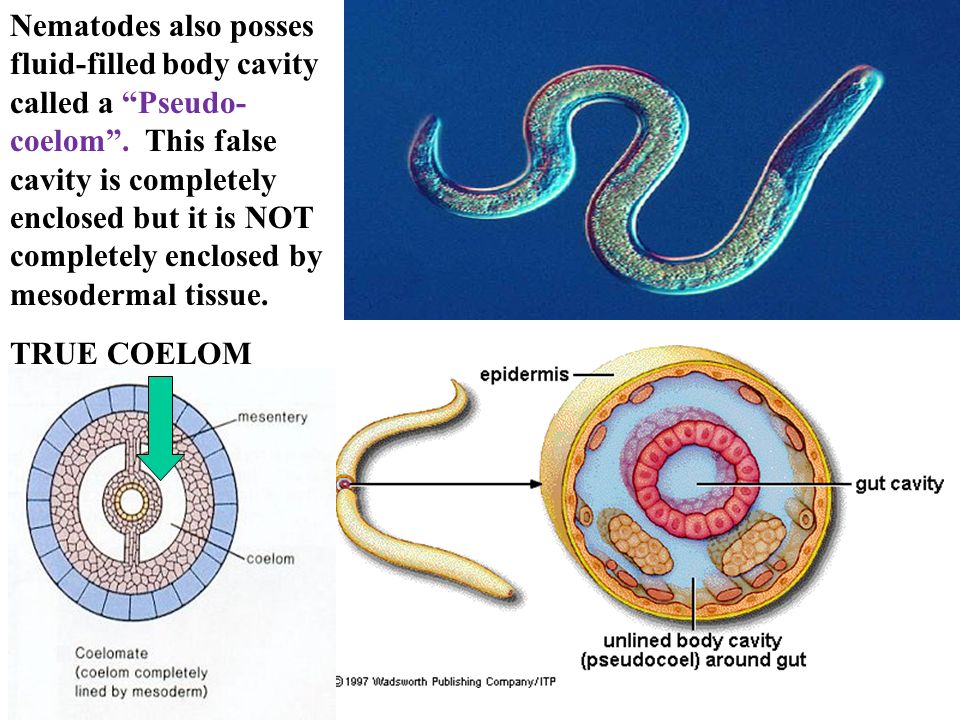 Phylum aschelminthes ppt, Kingdom Animalia: Phylum Platyhelminthes helmint fertőzések bennünk