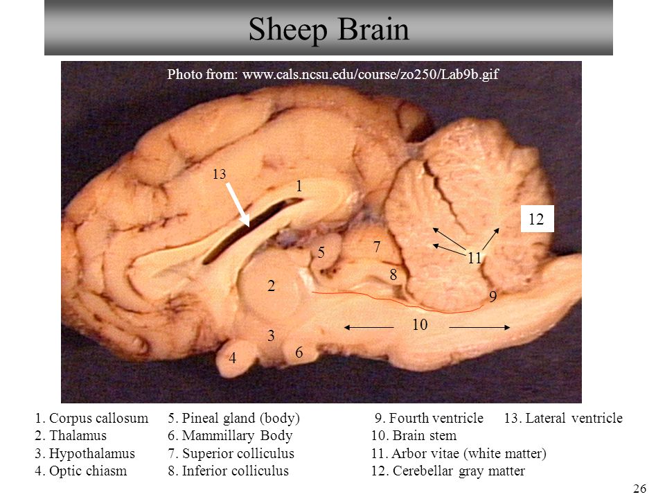 Neuron Spinal Cord Histology Brain Anatomy Sheep Brain