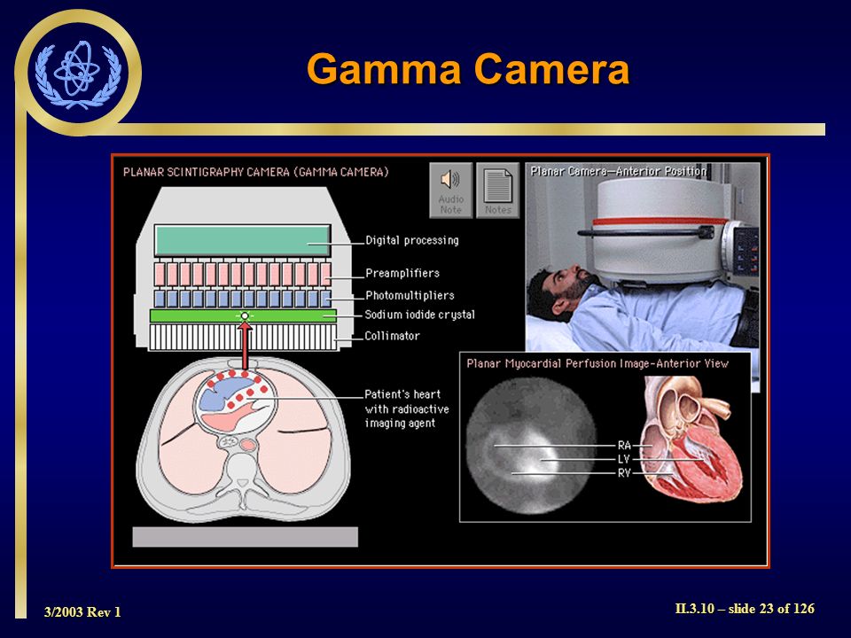 Gamma Camera