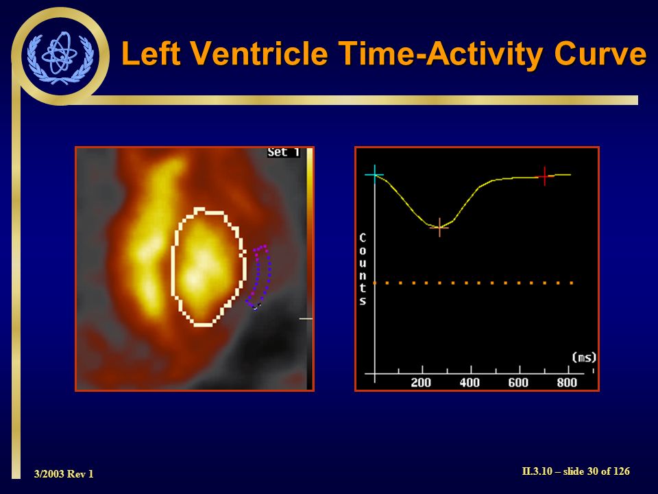 Left Ventricle Time-Activity Curve