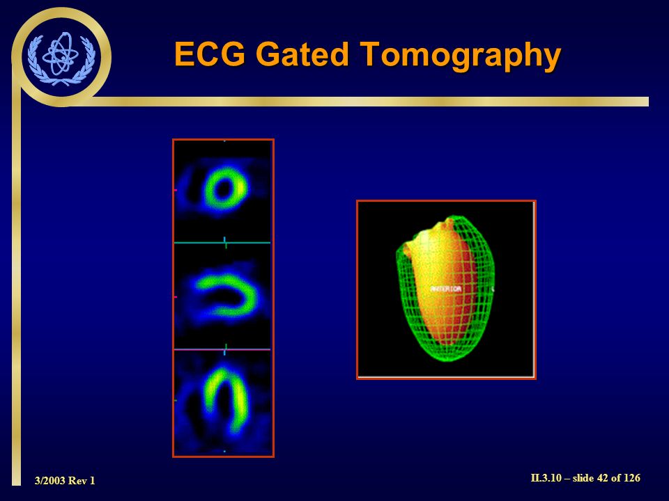 ECG Gated Tomography