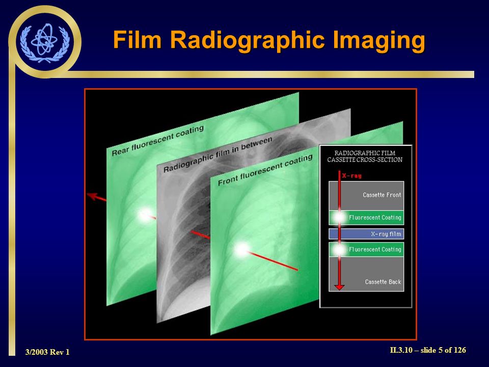 Film Radiographic Imaging