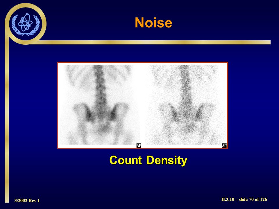 Noise Count Density