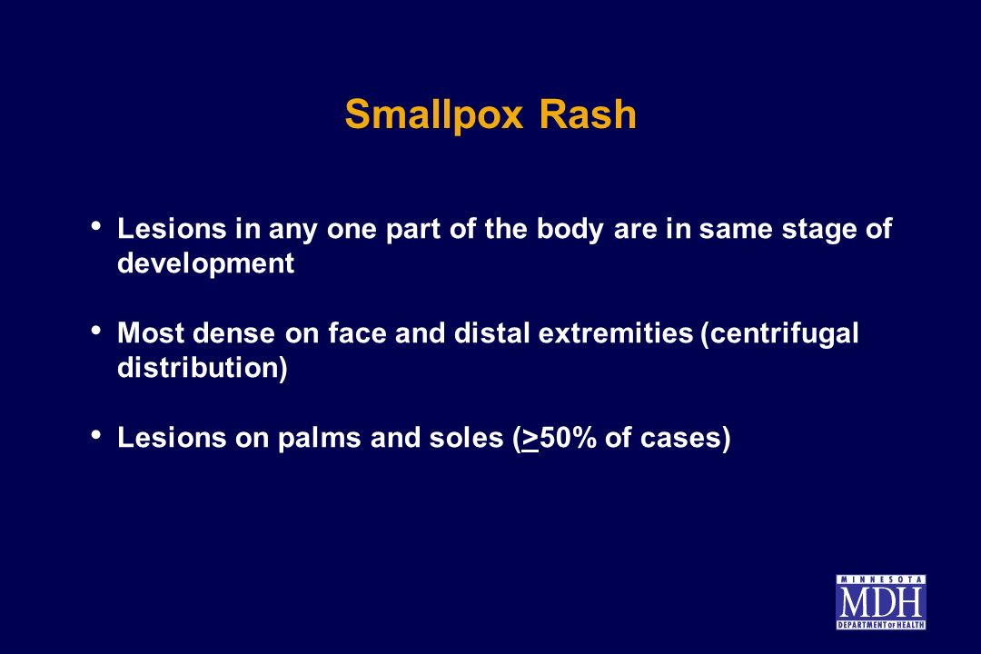 Overview of Smallpox ppt video online download