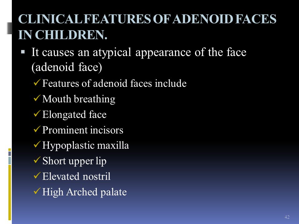 adenoid facies features