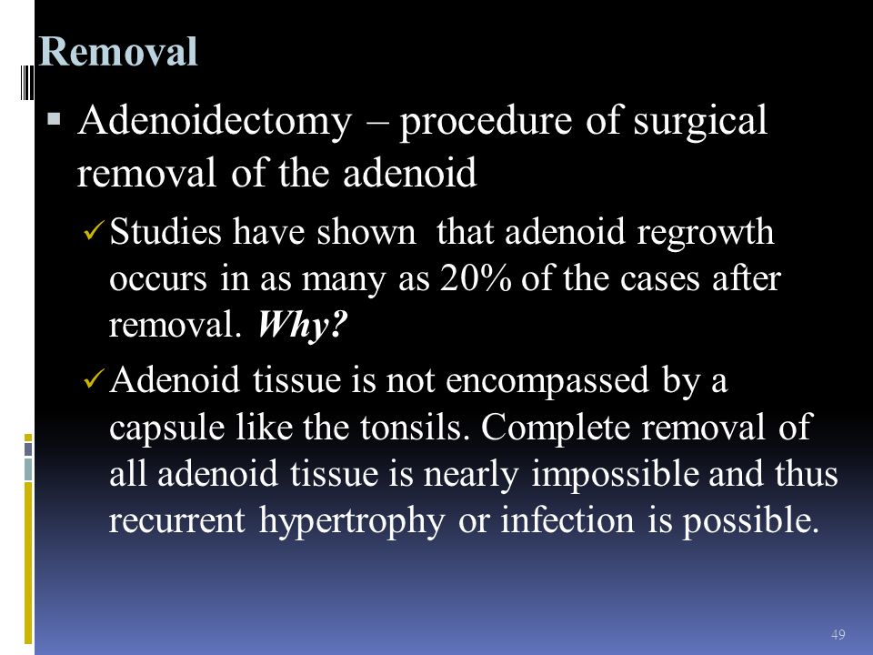Adenoidectomy – procedure of surgical removal of the adenoid