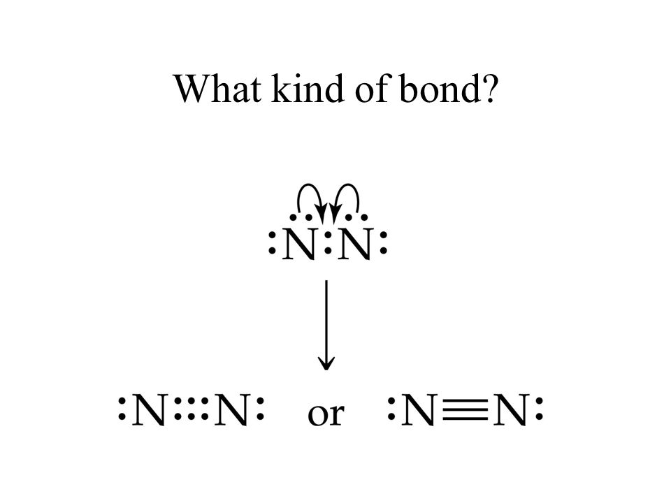 What kind of bond