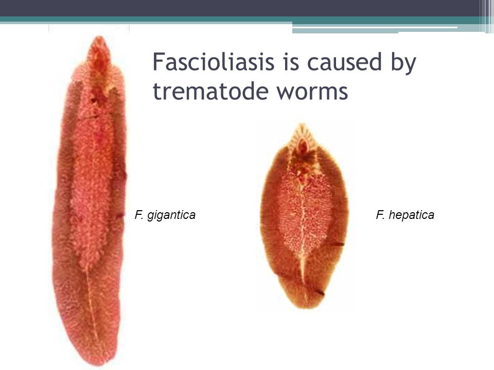 trematode fascioliasis giardiasis és allergia