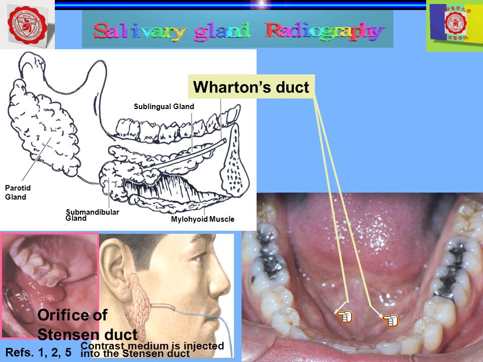Salivary Gland Radiography - ppt video online download