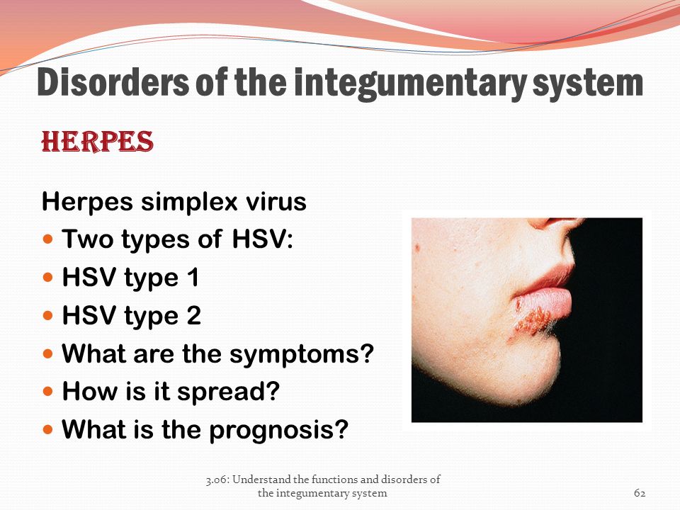 Herpes simplex virus 1 2 положительный