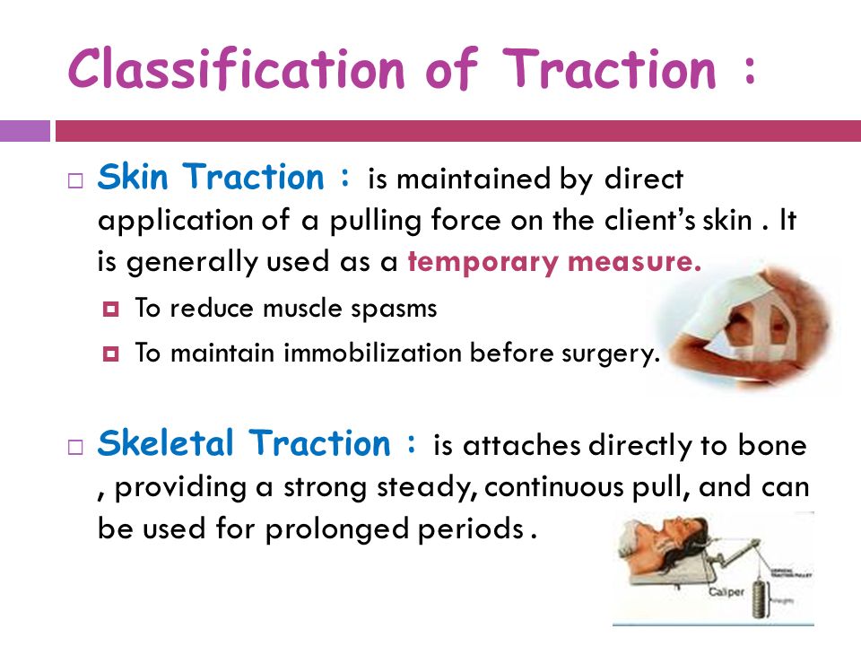Care of client with traction ppt video online download