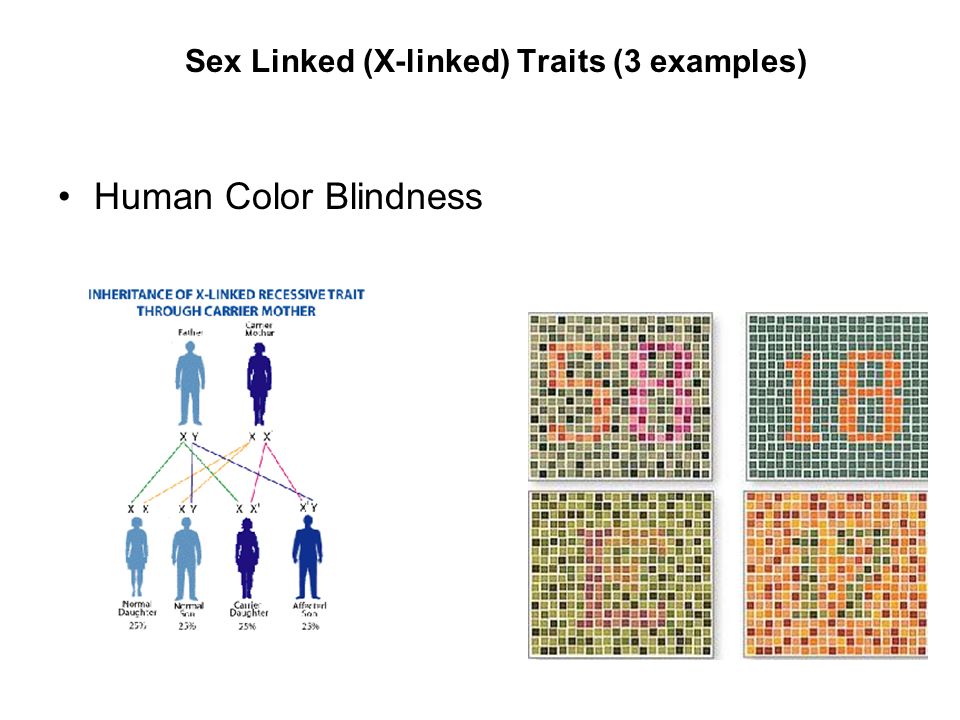 Sex Linked (X-linked) Traits (3 examples) .
