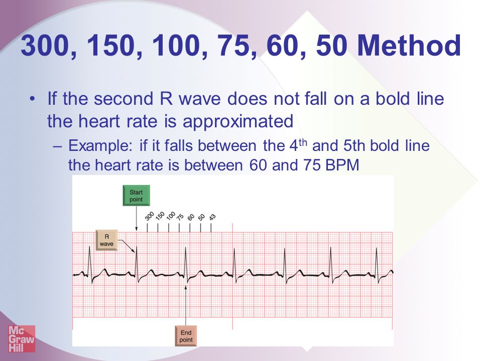 Fast Easy Ecgs A Self Paced Learning Program Ppt Video Online Download Fast Easy Ecgs A Self Paced Learning Program Ppt Video Online Download