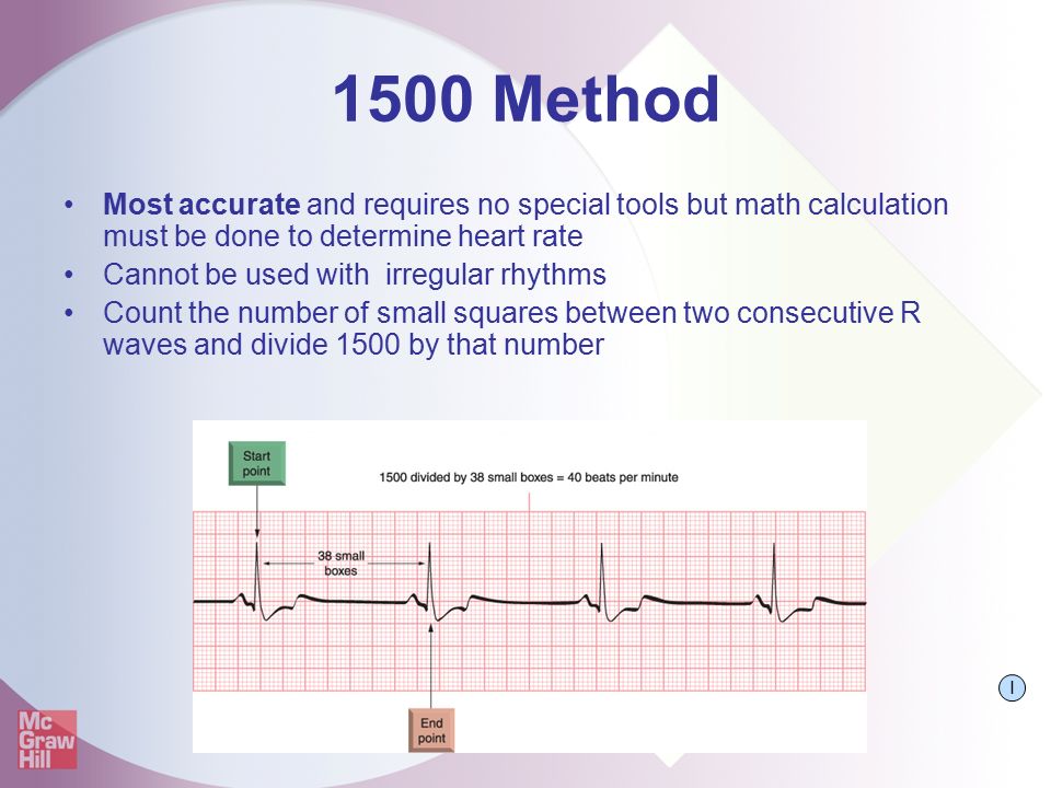 Fast Easy Ecgs A Self Paced Learning Program Ppt Video Online Download