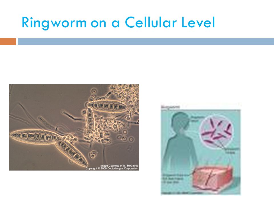 Ringworm on a Cellular Level