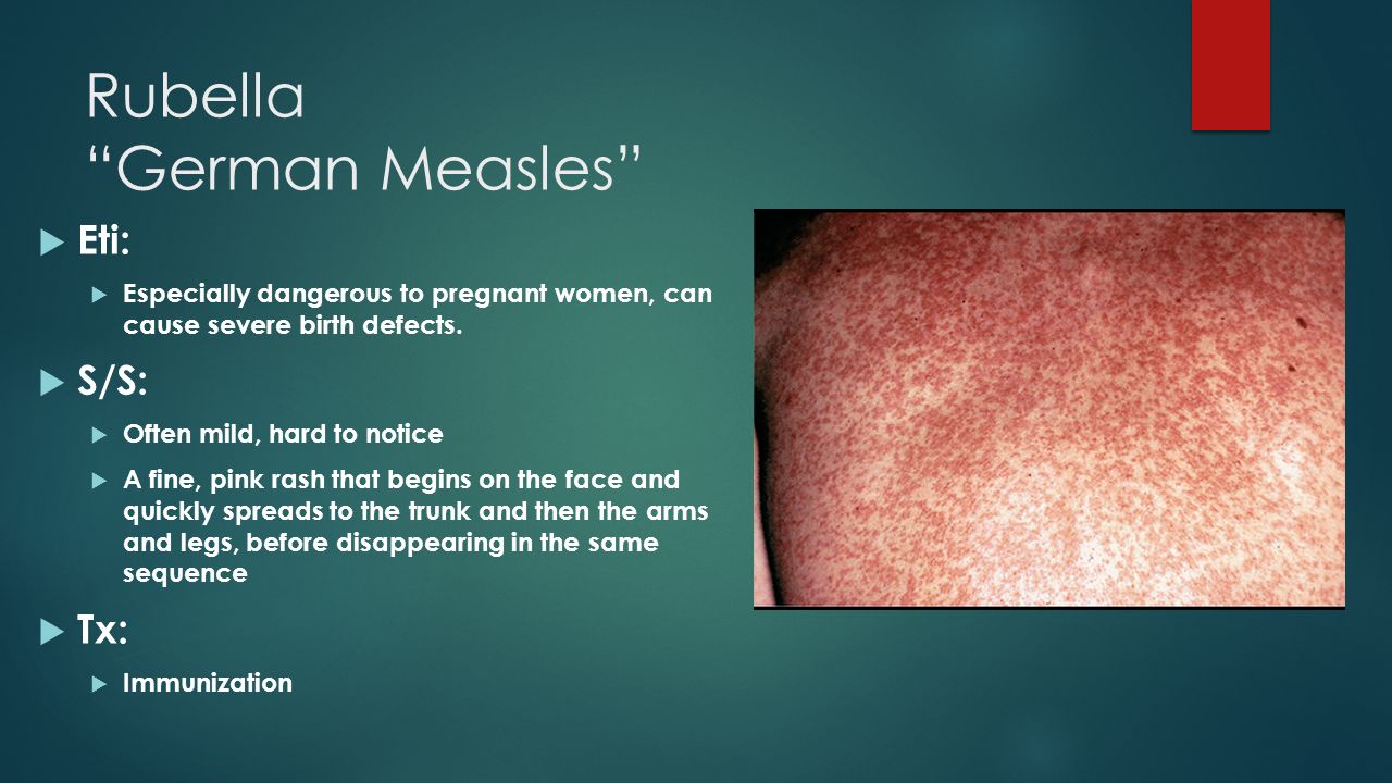 Rubella German Measles.